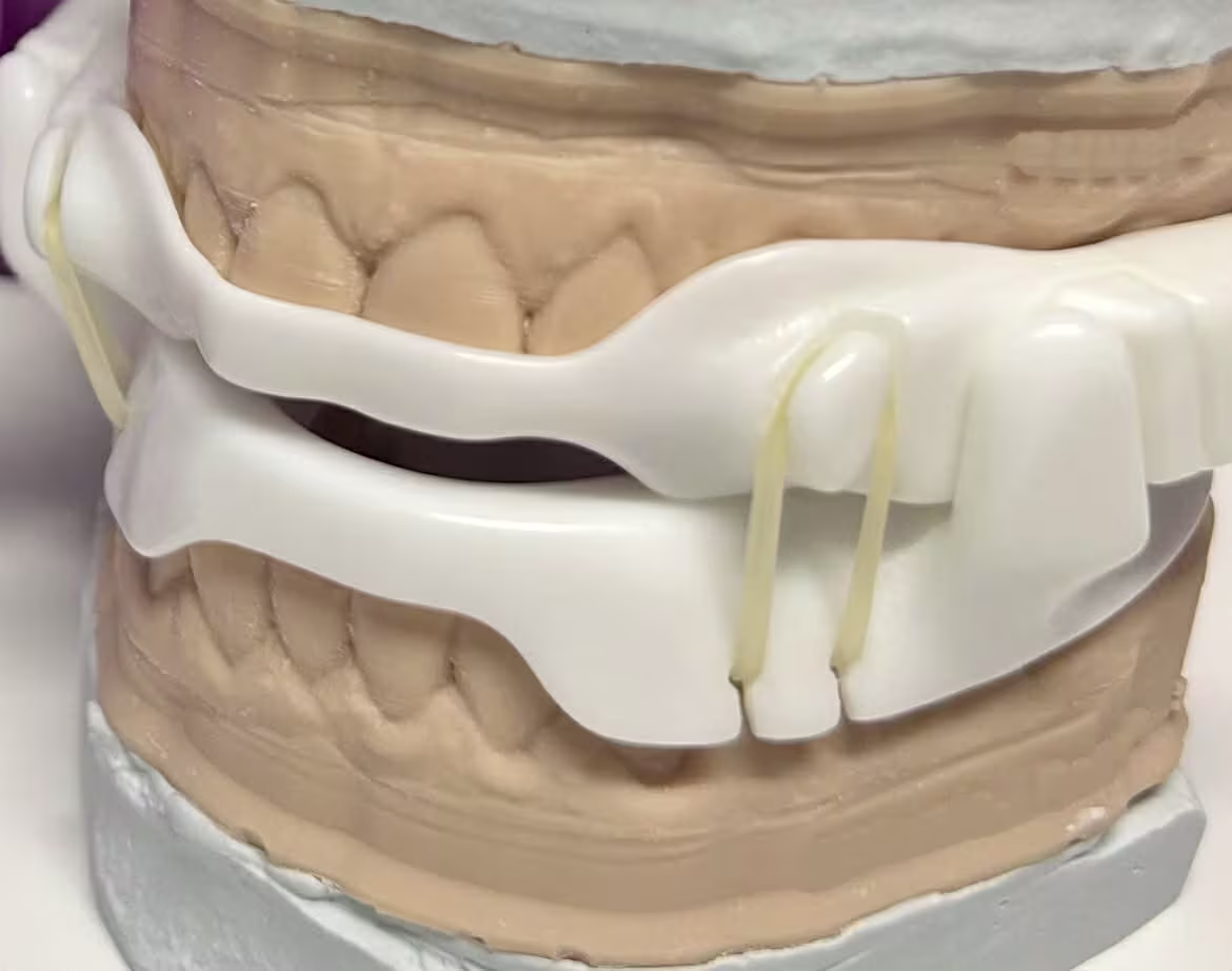 ce578 - Content - Selection of the MAD Device - Figure 145