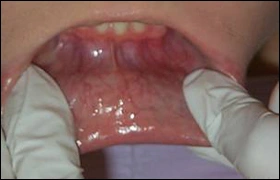 ce337 - Content - Labial Mucosa - Figure 2