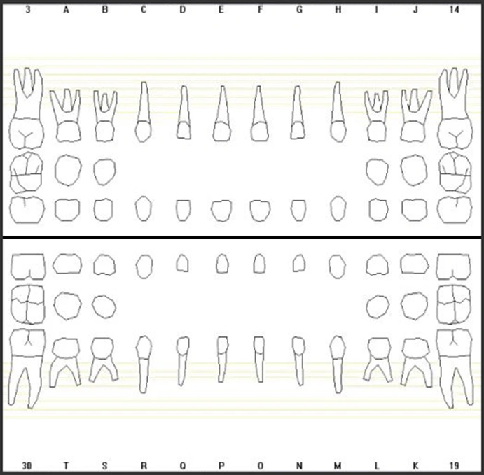 Image of universal numbering system for child teeth.