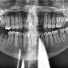 Practical Panoramic Imaging - Dentalcare Course | Dentalcare