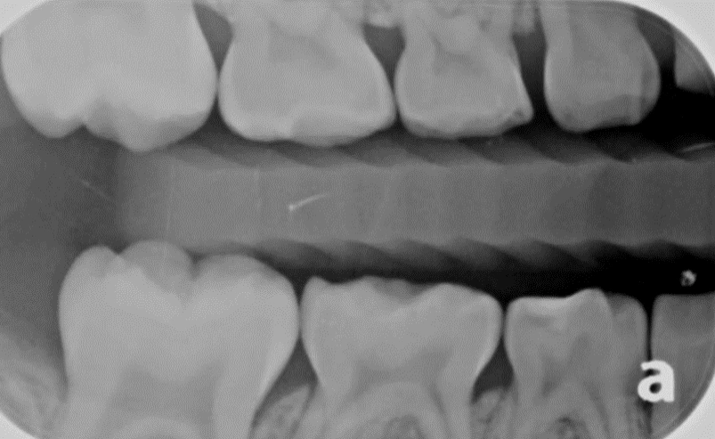 ce63-fig 2