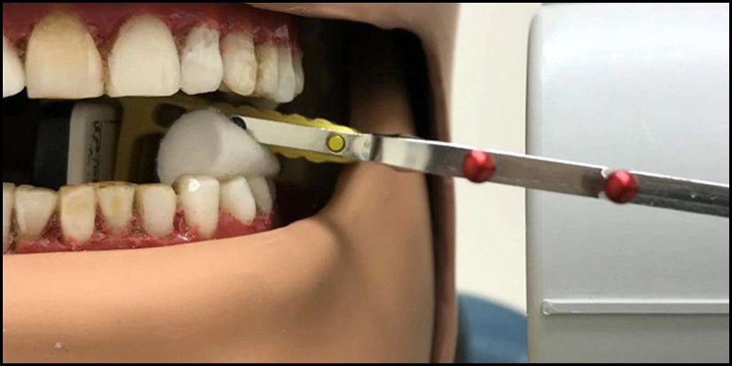 Problem 3 Fail to Capture Distal of Canine on Premolar Bitewing Image