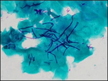 image showing photomicrograph of tissue