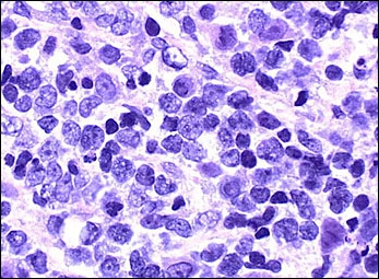 Case Challenge 40 - Content - Diagnostic Information - Figure 4