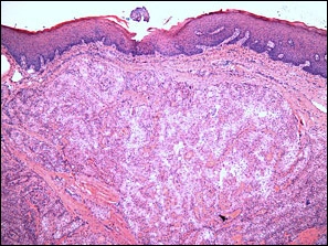 Case Challenge 43 - Content - Diagnostic Information - Figure 2