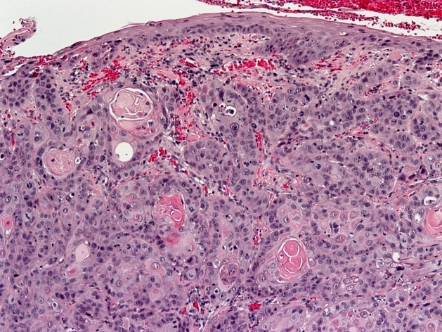 Case Challenge 64 - Content - Diagnostic Information - Figure 4