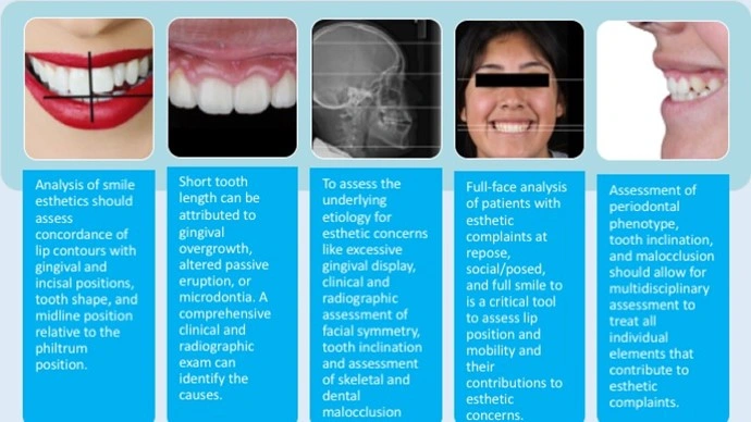 Components of An Ideal Smile - Figure 1