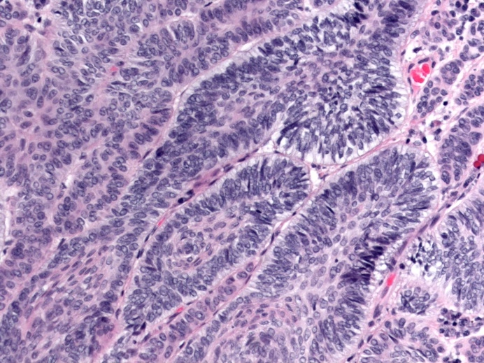 Case Challenge 60 - Content - Diagnostic Information - Figure 4