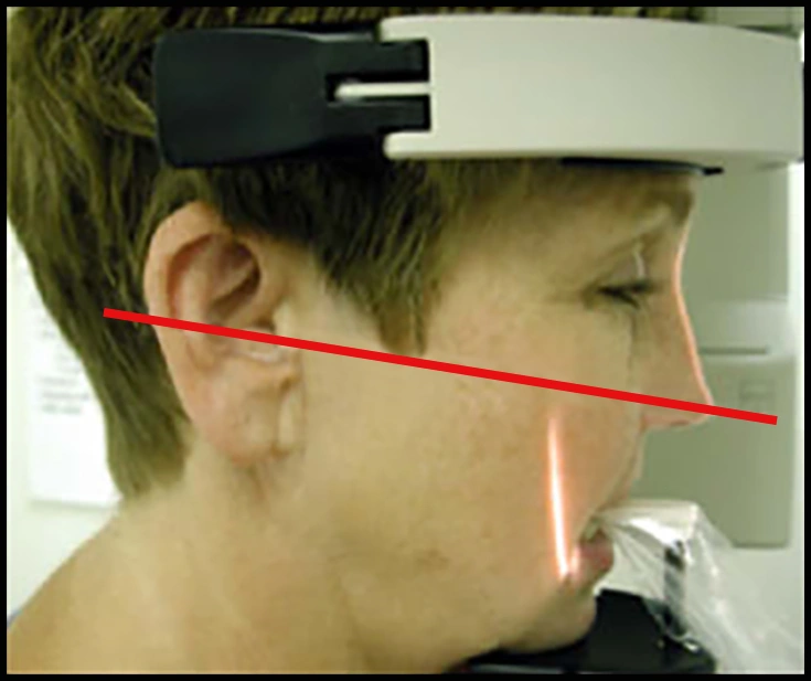 ce589 - Content - Incorrect Head Orientation - Figure 6