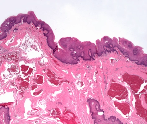 Case Challenge 74 - Content - Diagnostic Information - Figure 2