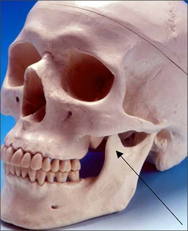 Maxillary Posterior Landmarks - Intraoral Radiographic Anatomy - Dentalcare