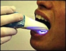 Photo showing the QLF hand-piece orientation for lower-right occlusal images