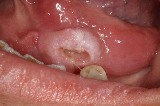 Case Challenge 54 - Content - Select Diagnosis - Figure 1