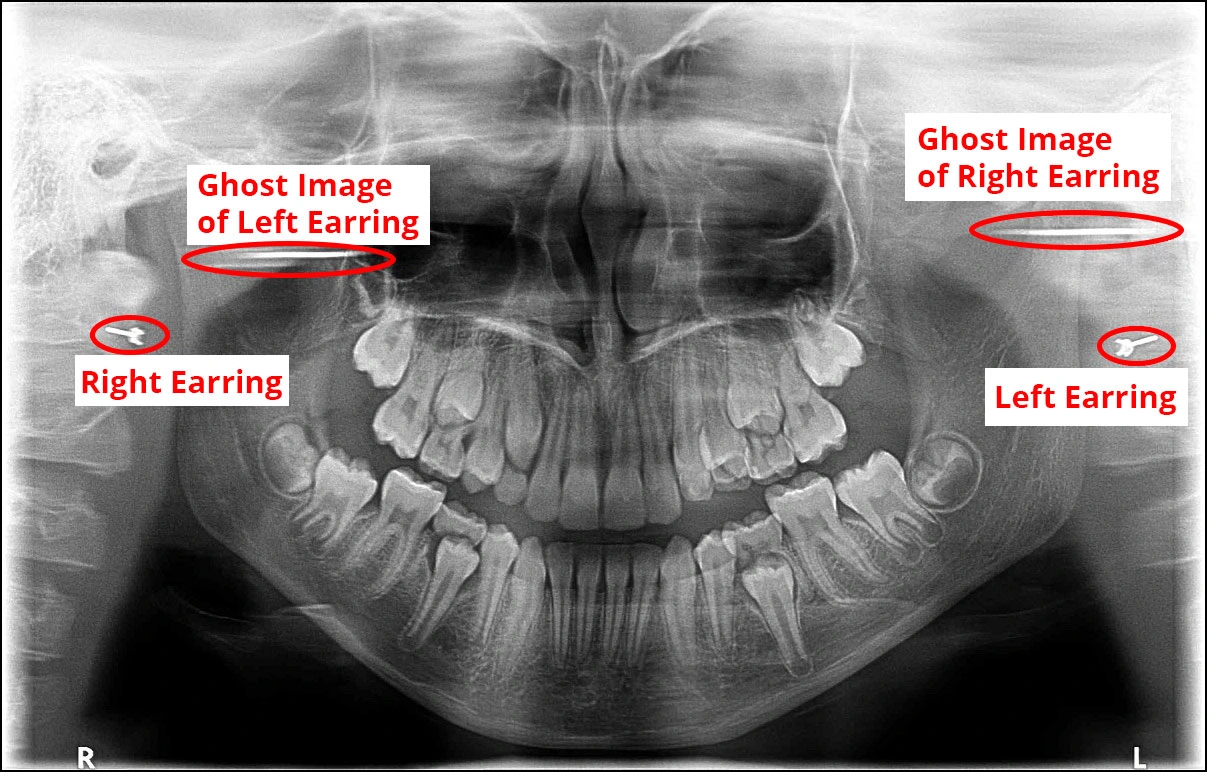 Image of appearance of ghost image.