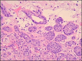 fig06-photomicrograph-high