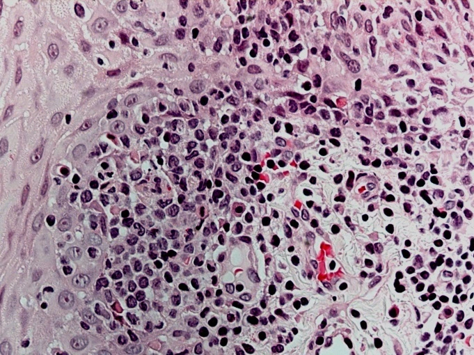 Case Challenge 67 - Content - Diagnostic Information - Figure 8