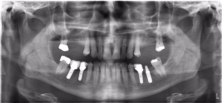 ce589
Image Evaluation - Figure 22