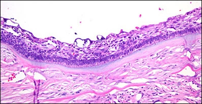 fig12-epithelial-lining-high