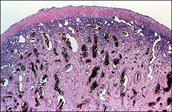 image showing photomicrograph of tissue