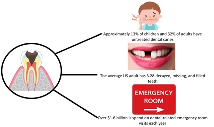 Image showing the impact of caries in children and adults.