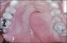 usapeptide melanotan No One Knew What a Peptide Was 5 Years AgoNow They're Everywhere. But What  Exactly Is a Peptide?