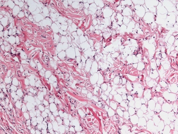 Case Challenge 59 - Content - Diagnostic Information - Figure 3