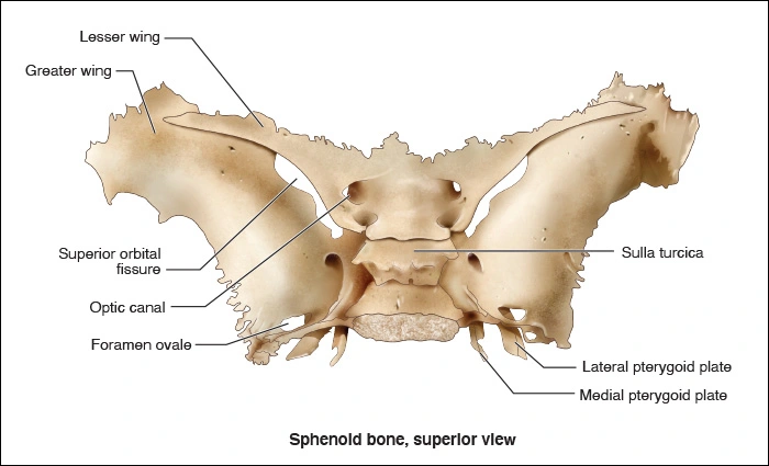 Sphenoid Bone - Head and Neck Anatomy: Part I – Bony Structures ...