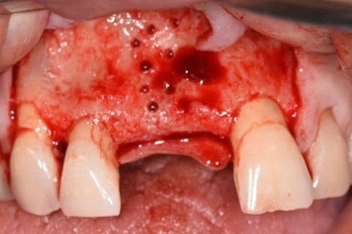 Surgical Technique - Figure 3