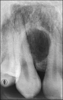 Case Challenge 29 - Content - Select Diagnosis - Figure 1