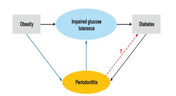 Obesity and oral health