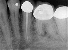 Case Challenge 28 - Content - Diagnostic Information - fig02-radiograph