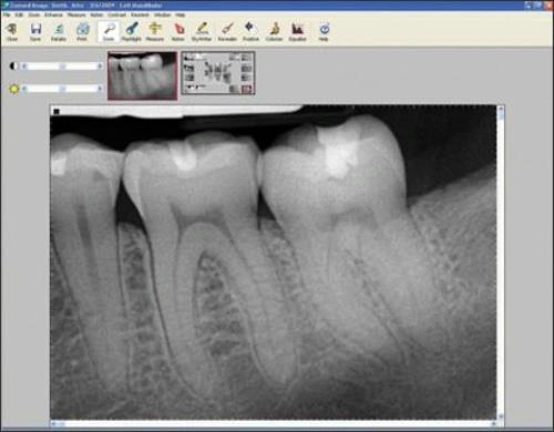 ce512 Fig 26