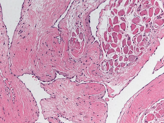 Case Challenge 74 - Content - Diagnostic Information - Figure 3