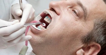 Man during teeth whitening