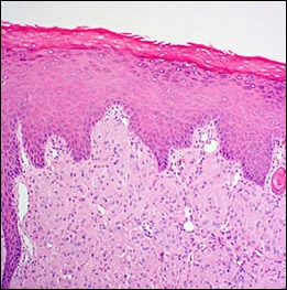 fig02-photomicrograph-low 