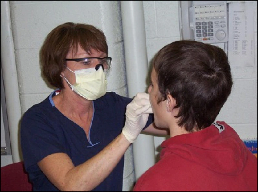 Photo showing application of fluoride varnish in a community-based setting.