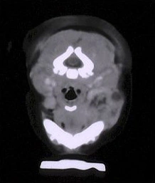 Case Challenge 1 - Content - Diagnostic Information - Figure 3