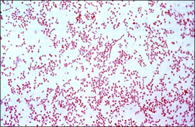 Microbiology of Odontogenic Infections - Adjunctive and Prophylactic ...