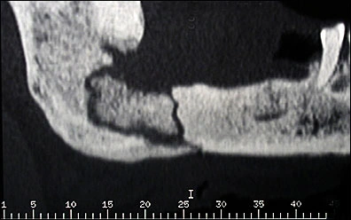 fig04-ct-scan