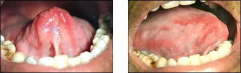 case challenge 46 - Content - Select Diagnosis - Figure 1