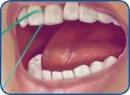 Regular Dental Visits 3
