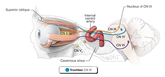 Figure 10. Cranial Nerve IV - Trochlear Nerve