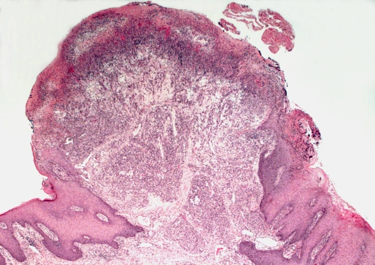 Case Challenge 61 - Content - Diagnostic Information - Figure 3