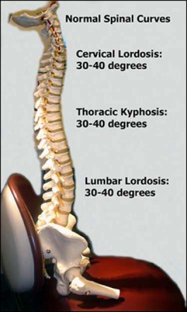 Image of normal spinal curves.