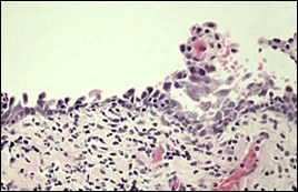 fig07-photomicrograph-high