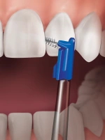 Dental implants pro