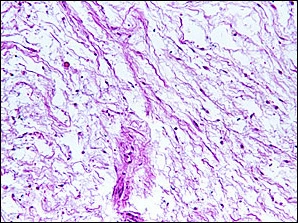 Case Challenge 12 - Content - Diagnostic Information - Figure 8