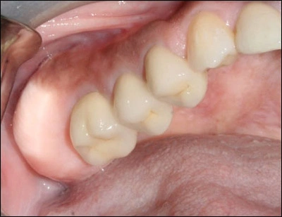 Case Challenge 48 - Content - Select Diagnosis - Figure 1