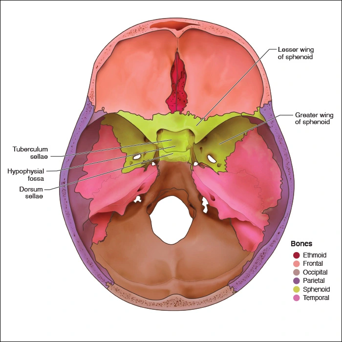 Sphenoid Bone Head And Neck Anatomy Part I Bony Structures Dentalcare 1203