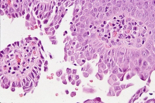 Case Challenge 65 - Content - Diagnostic Information - Figure 4